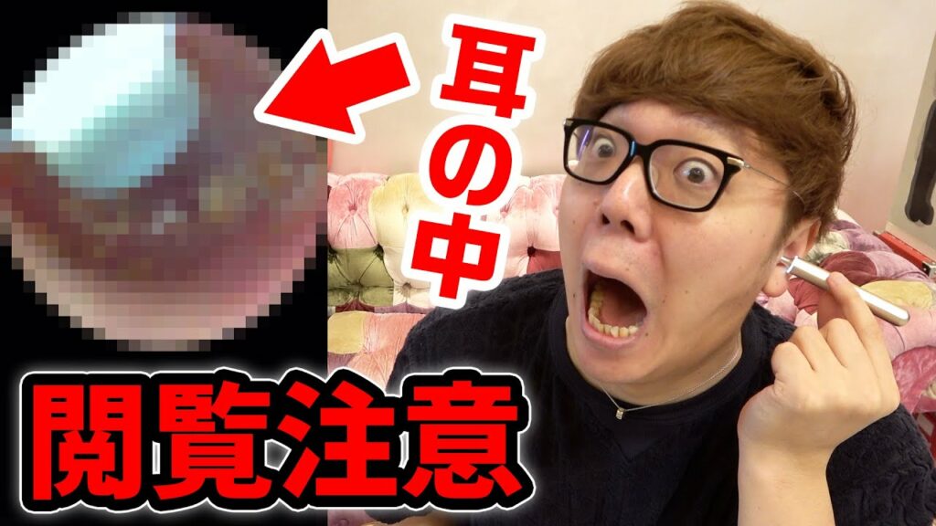 【閲覧注意】ヒカキンの耳の中をカメラ付き耳かきで見たら汚すぎて放送事故…耳垢・耳クソ取りまくり!【耳掃除】